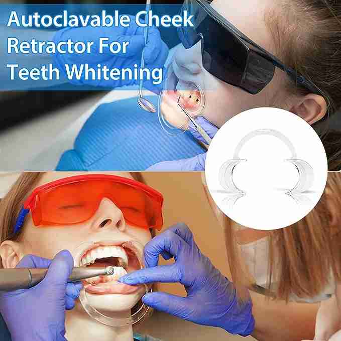 Teeth Whitening C Shape Mouth Opener – Clear Cheek Retractor