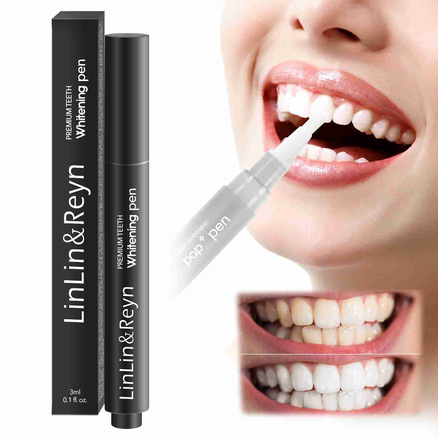 Teeth Whitening Gel Pen – 3ml On-the-Go