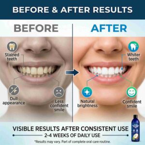 Teeth Whitening Coconut Oil Pulling Mouthwash – Alcohol-Free